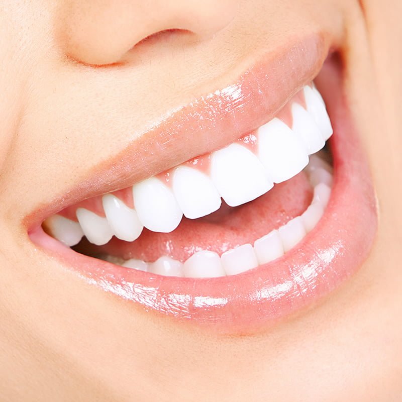 tratamente dentare Iasi, clinica stomatologica Iasi