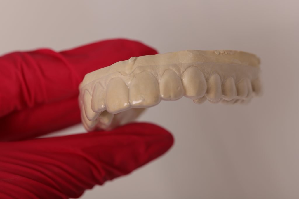 proteza pe implant Iasi, proteza dentara, protetica