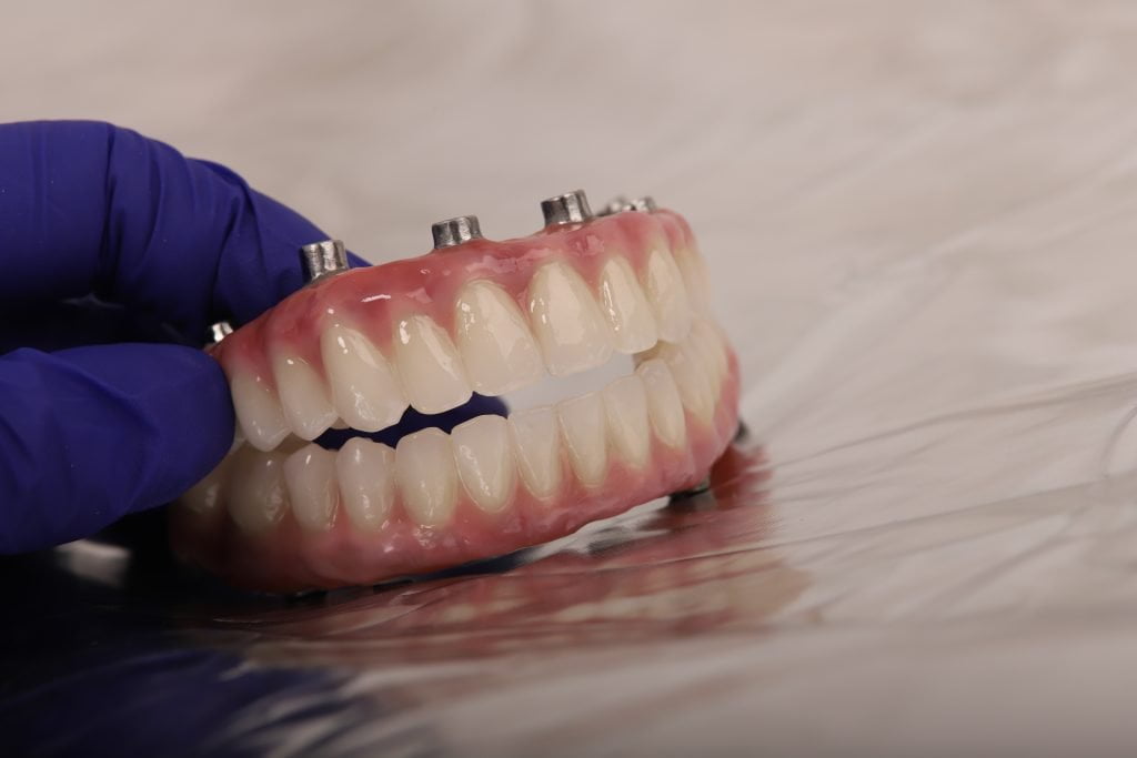 implant dentar Iasi, coroana dentara zirconiu, detartraj Iasi