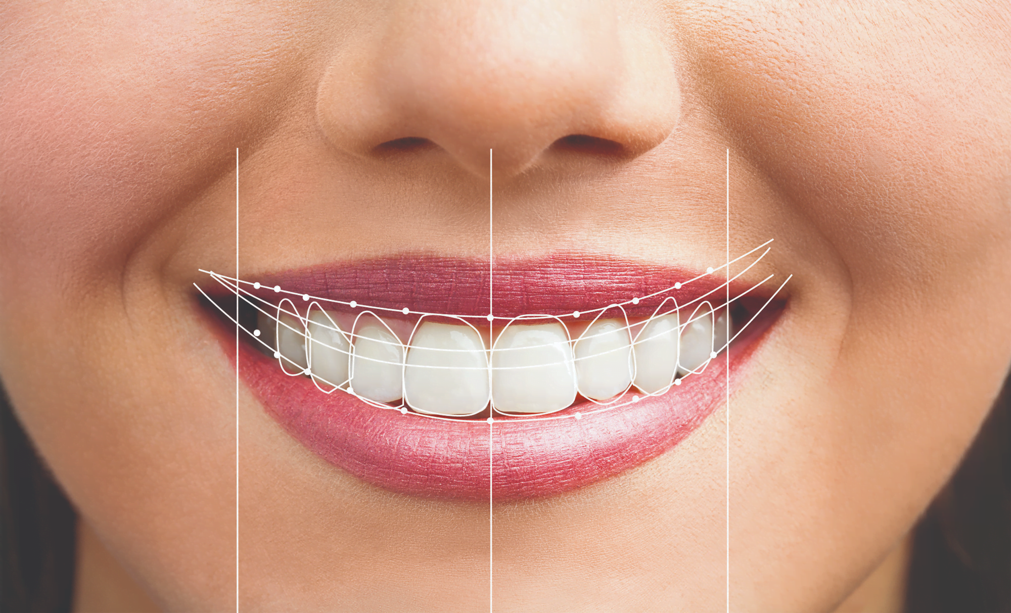 DSD - Digital Smile Design Iasi